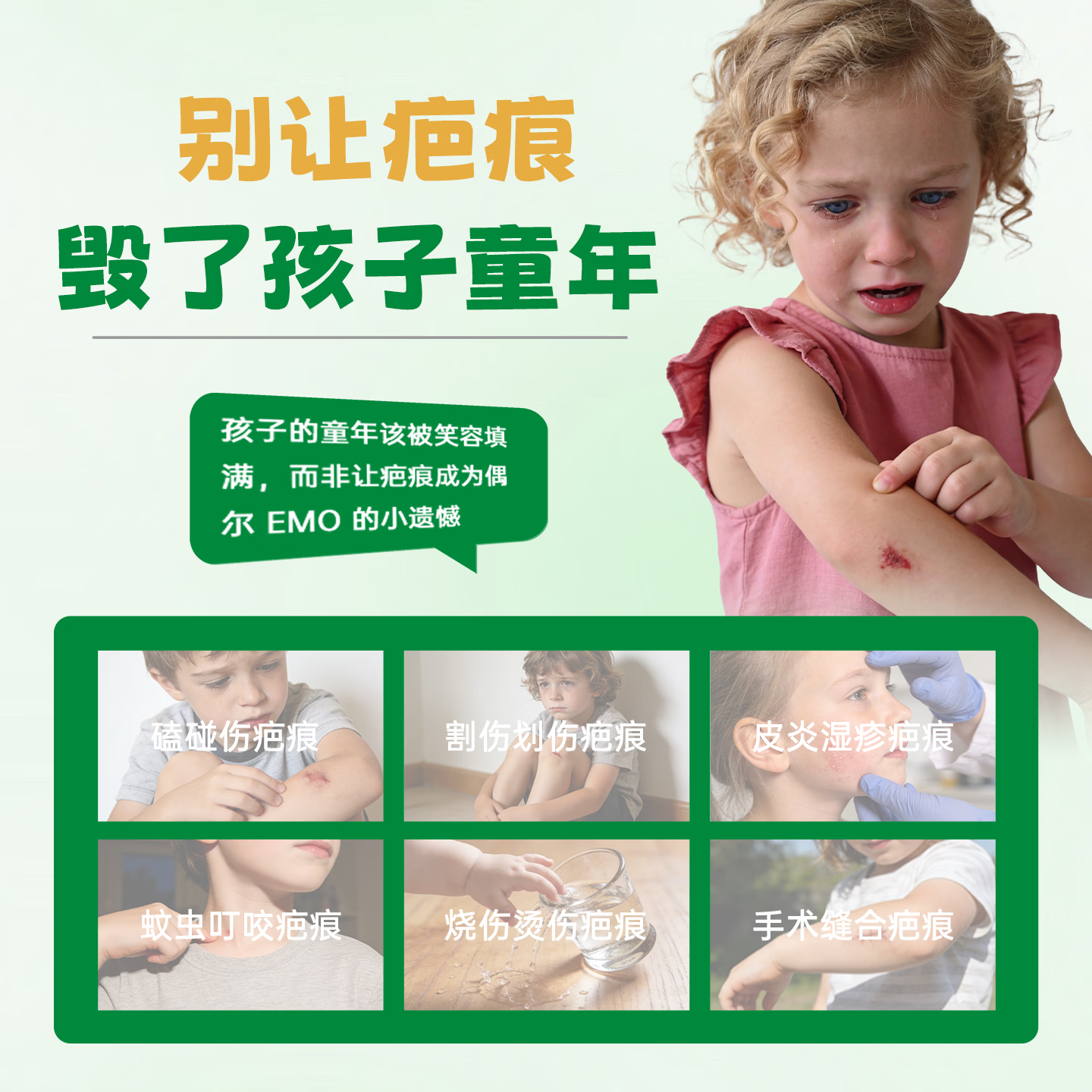 润好儿童自风干型祛疤硅凝胶烧烫伤手术缝合磕创伤疤痕修复祛疤膏去疤 儿童款20g/1支体验装【小面积轻微创面新疤推荐】