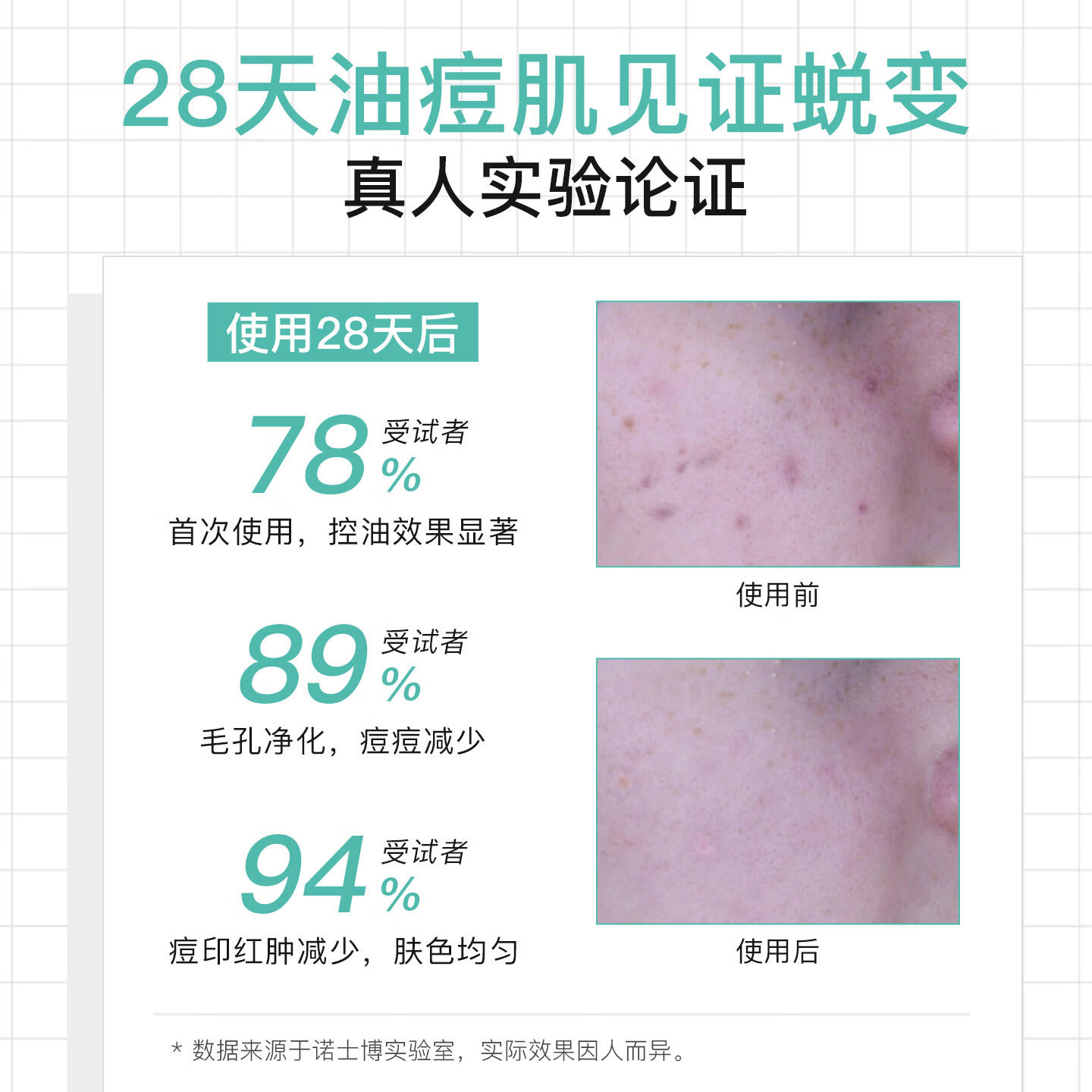 诺士博（NOVEXPERT）诺士博青少年面霜 祛痘控油去黑头淡痘印 痤疮青春期男女30ml 【嫩肤平滑】青少年祛痘控油面霜 30ml