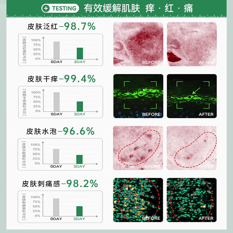 岩井昃弘湿疹膏十大牌子进口湿疹膏止痒抑菌皮肤瘙痒去顽固湿毒真菌感染 特效3盒【100%一抹见校】湿疹膏药十大牌子 湿疹十大牌子皮肤瘙痒皮炎湿疹