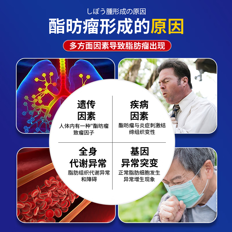 云南本草脂肪康脂肪瘤专用膏药去除神器消除硬块鼓包脂肪消散膏皮下囊肿 3盒贴+3盒膏【一次性冶裉】 陈九玄脂肪瘤膏皮下多发性鼓包