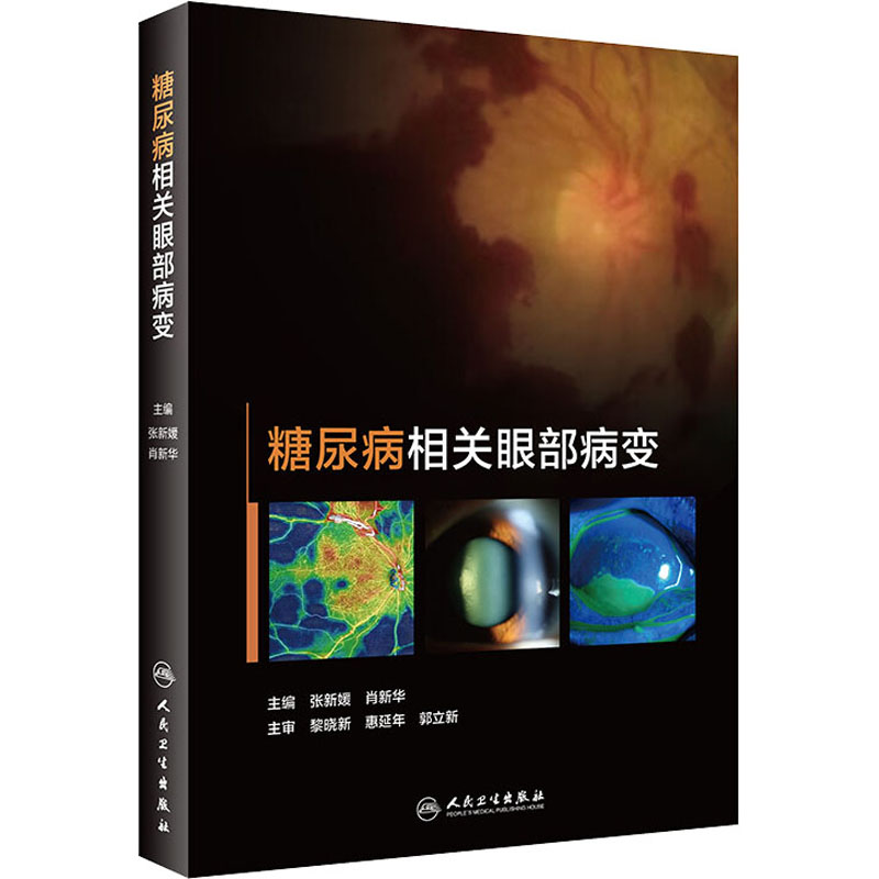 糖尿病相关眼病治疗管理书 糖尿病视网膜病变黄斑水肿眼表病变视神经