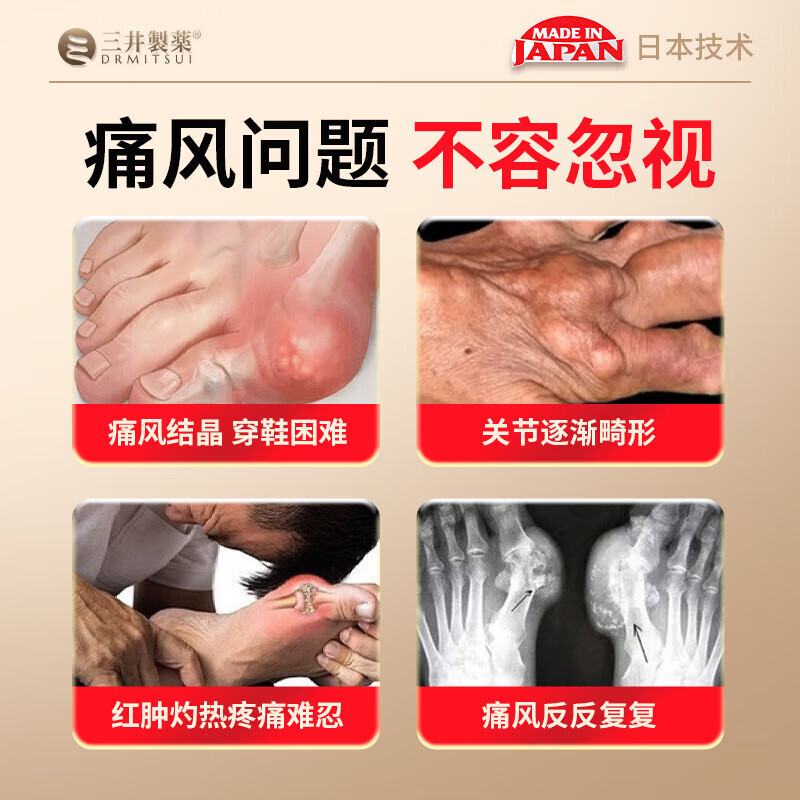 三井制药痛风止痛石溶远红外骨痛凝胶痛风肩周炎腰间盘突出颈椎膝 1支装[贵在运费不推荐]