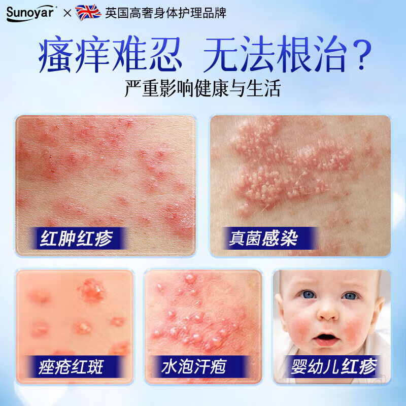 Sunoyar湿疹药膏止痒皮肤瘙痒红斑痤疮真菌感染汗状肛门瘙痒阴囊潮湿 10支装【买5送5超划算】重度痤疮红斑适用