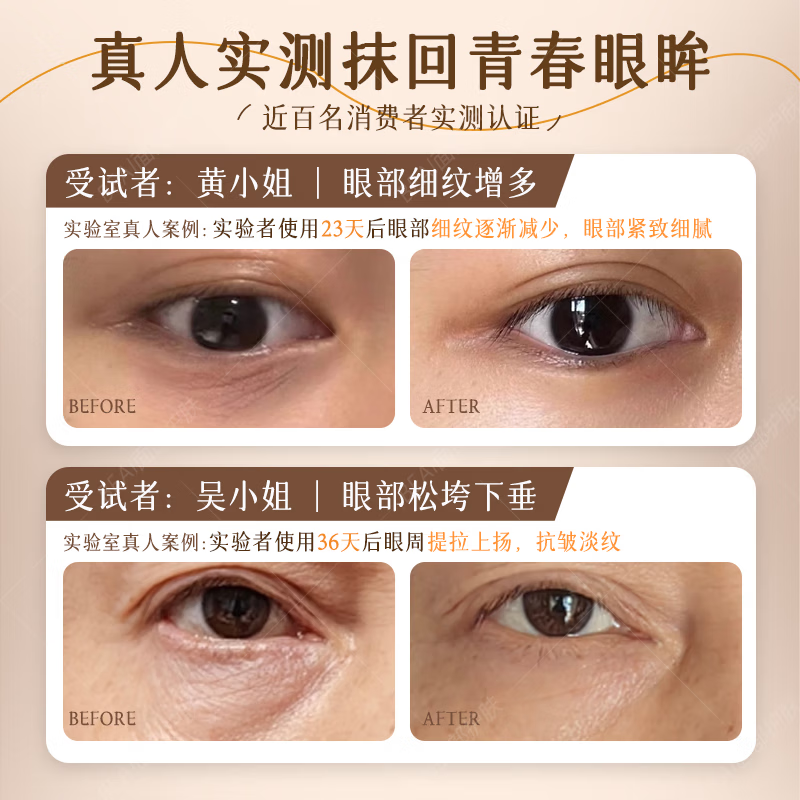 芙诗婷黄芪抗皱紧致眼霜淡化细纹眼袋提拉紧致抗皱淡化黑眼圈熬夜护眼霜 黄芪抗皱眼霜30ml*1