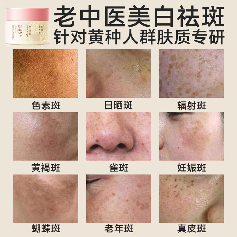 老中医（LAOZHONGYI）呼唤美白祛斑霜烟酰胺面霜色斑淡化黑色素去雀斑黄褐斑护肤品男女 【有效祛斑】呼唤美白祛斑雪肌霜