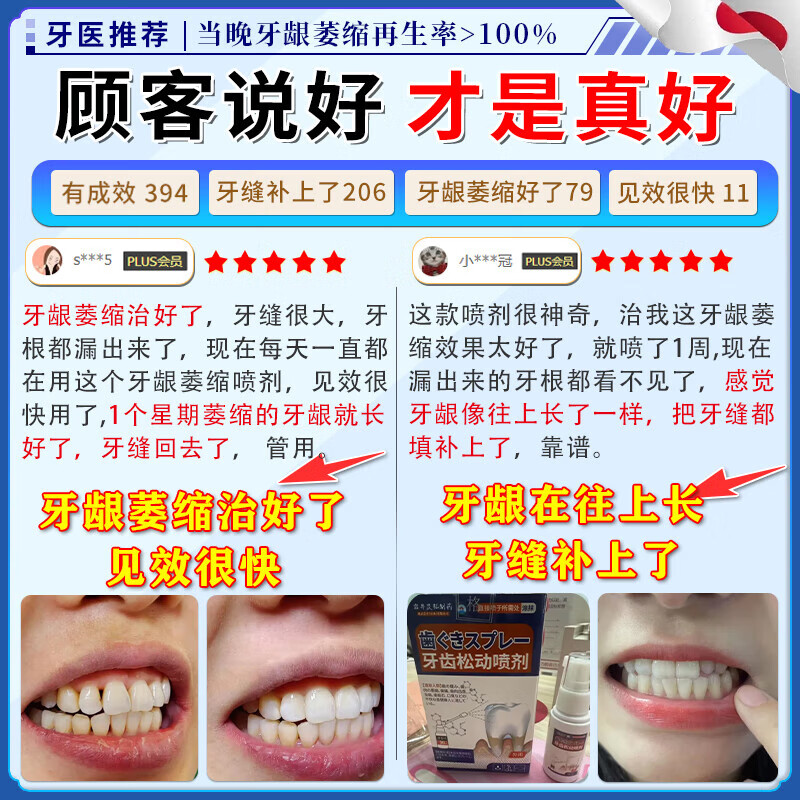 岩井昃弘牙膏护龈固齿牙龈萎缩修复再生专用喷剂牙根外露牙周炎固齿凝胶 单盒装喷剂 牙膏金榜第一重度牙齿松动进口
