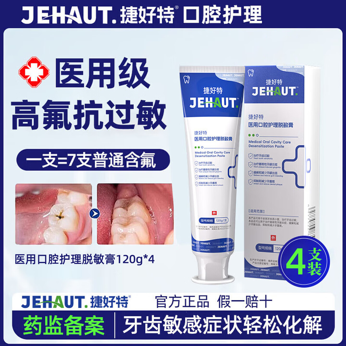 捷好特医用脱敏膏牙龈萎缩牙周炎专用牙龈出血去口臭去黄去牙结石去牙渍 【专治牙龈敏感】4支脱敏膏 （480g） 京东折扣/优惠券