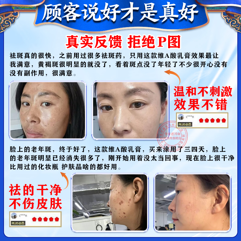 [臣功]维A酸乳膏 祛斑霜黑色素祛斑专用药黄褐斑日晒斑雀斑老年斑强力祛除手脸部消除男女专【视觉特效】 15克/支 1盒装 【标准装】