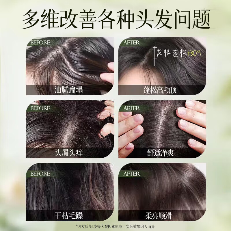 劳丽诗植物萃取洗发水清爽顺滑滋润柔顺蓬松去屑男女通用乌黑亮泽洗发露 植萃洗发水300ML-2瓶