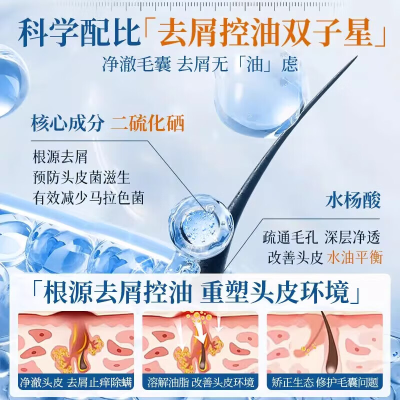 儒意二硫化硒去屑清洁洗发水毛囊止痒控油蓬松炎洗头膏露正品 【蓝玫瑰香】二硫化硒洗发水800g