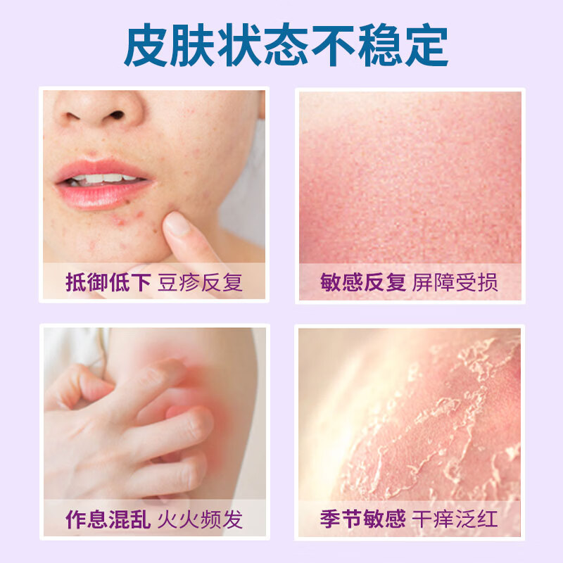 INNERHEATH茵澳斯 益生菌舒缓不适 无惧换季 成人皮肤修护 舒鼻抗过敏益生菌 日常维稳 皮肤修护 紫瓶 30粒*3瓶