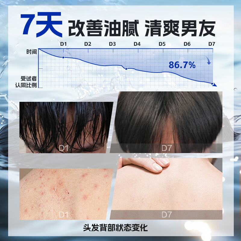 侗百谷古龙止痒去屑男士洗发水清爽控油蓬松持久留香沐浴露柔顺二硫化硒 【控油去屑】古龙香氛洗发水