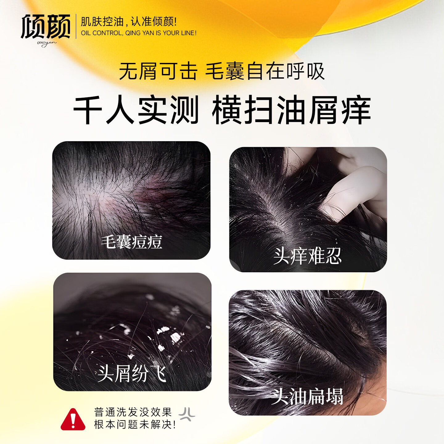 倾颜二硫化硒洗发水去屑止痒头皮毛囊头去油除螨虫蓬松净爽男士护发 拍1发2【到手两瓶】200ml*2