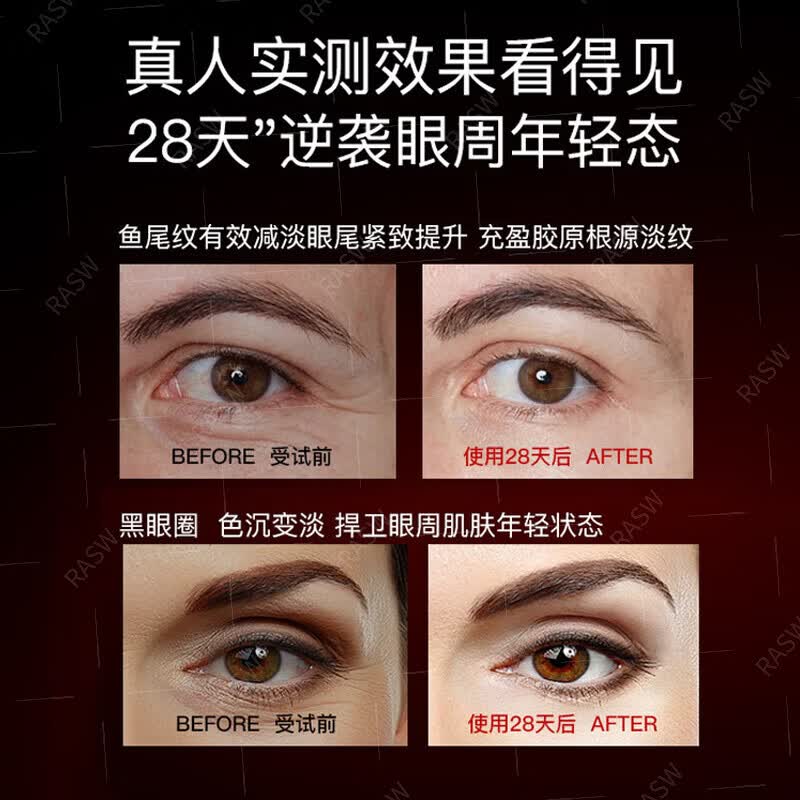 梦若羽RASW德国品牌离子美眼仪眼部按摩仪器提拉紧致眼袋淡化面部消肿 【眼部提拉】离子冲脉按摩 淡化眼纹黑眼圈 【官方旗舰 京质保障】