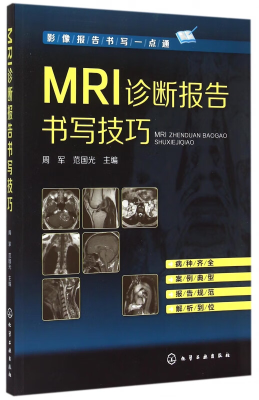 MRI诊断报告书写技巧(影像报告书写一点通)