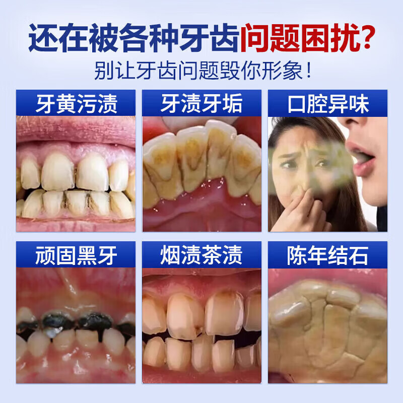 香港大药房去牙结石型口腔冲洗器喷雾牙齿膏去味口臭去黄溶解去渍牙石速效 5盒：（10年以上可掉）买3送2