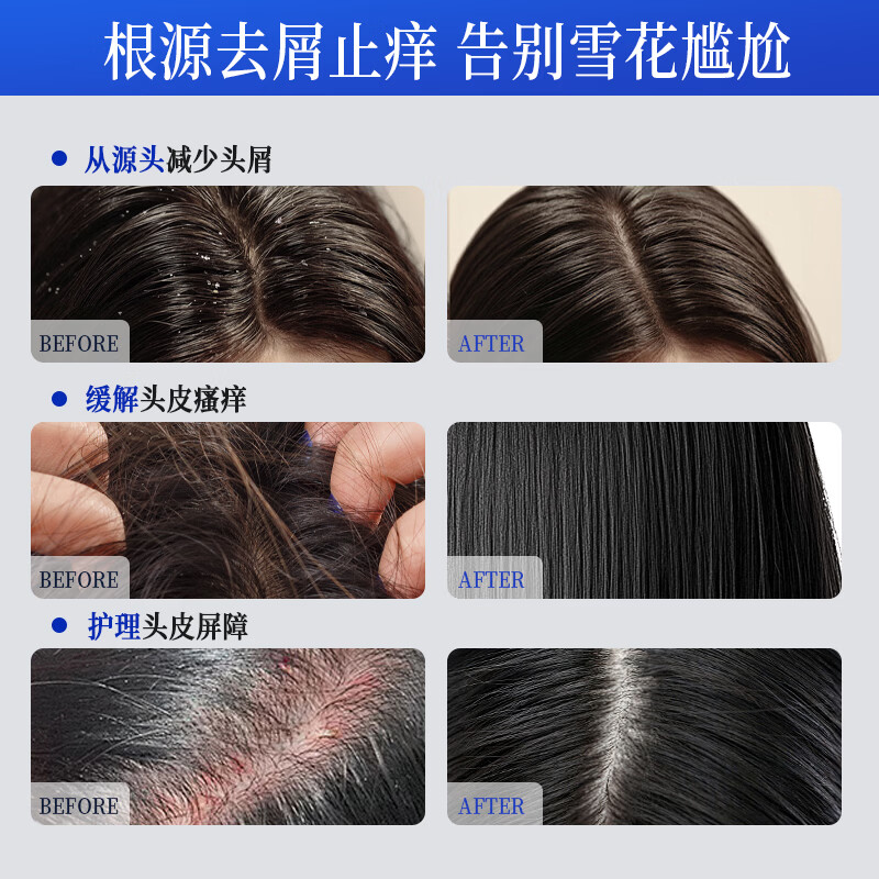 完好如初控油去屑洗发水蓬松发根持久留香顺发养发洗发露750ml 控油去屑750ml