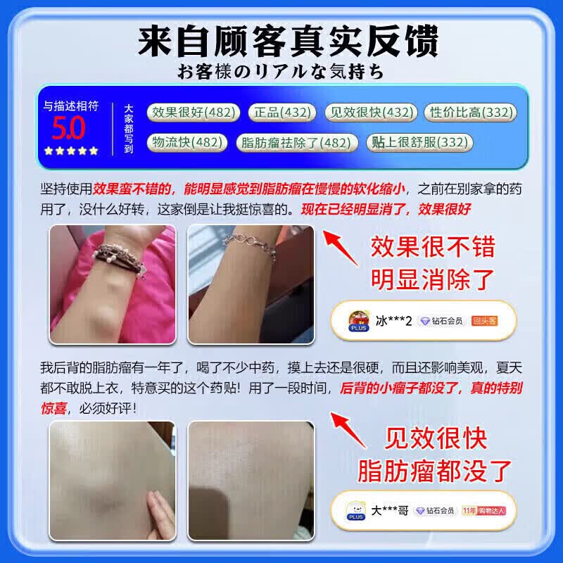 云南本草脂肪康脂肪瘤专用膏药去除神器消除硬块鼓包脂肪消散膏皮下囊肿 3盒贴+3盒膏【一次性冶裉】 陈九玄脂肪瘤膏皮下多发性鼓包