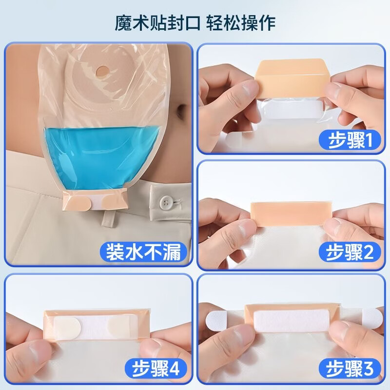 护士同学一件式造口袋可排气碳片除味医用直肠改道肛肠袋一次性大便造瘘袋 升级款双层底盘魔术贴【10片装】碳片除味