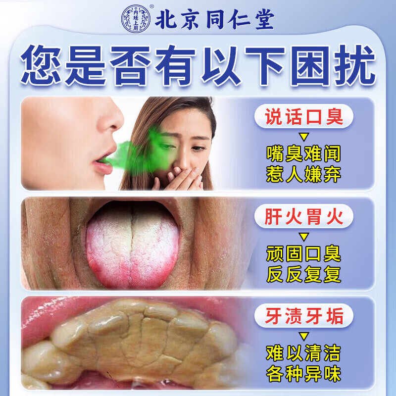 北京同仁堂牙膏去烟渍去黄去口臭去牙结石去牙渍清新口气重嘴巴臭抑菌除口臭 单盒装【不划算】