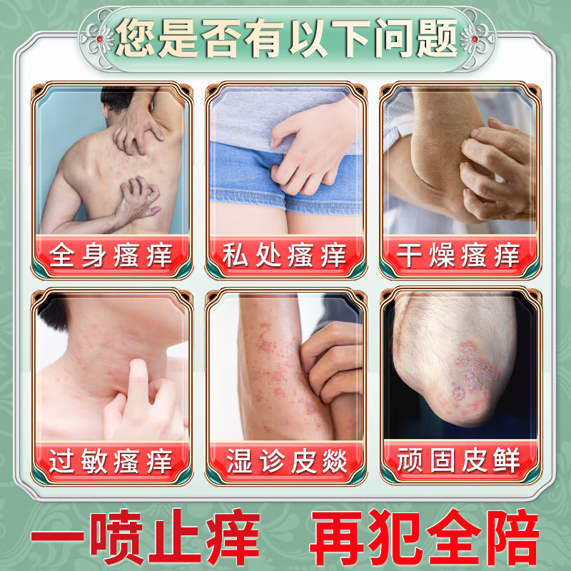 北京协和医学院止痒抑菌皮肤瘙痒身体痒止痒100%湿炎真菌感染皮疹过敏不反复 一盒装【老人皮肤痒】
