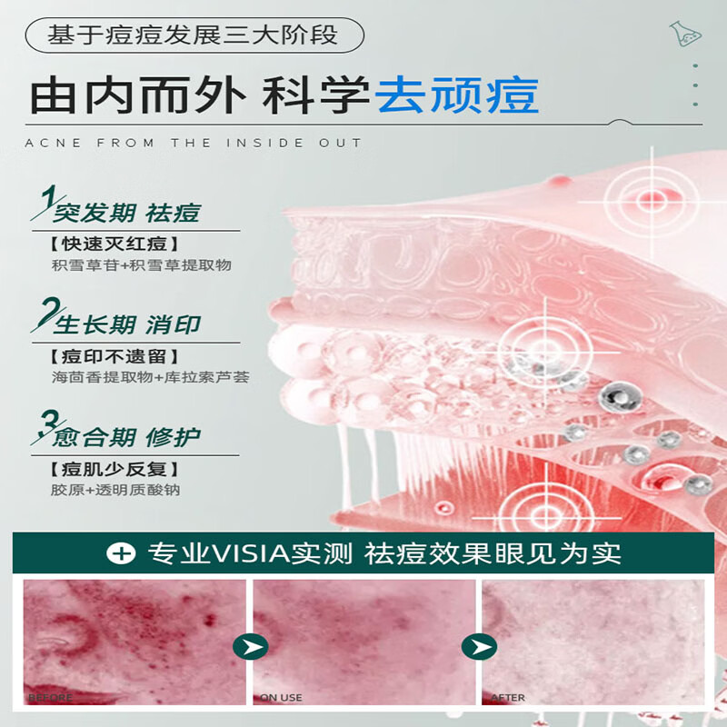 德德维芙（DETVFO）积雪草苷霜祛痘印修复霜24%唇周黑淡化黑色素沉淀复颜舒缓软膏 90g 三支装【买二送一更优惠】