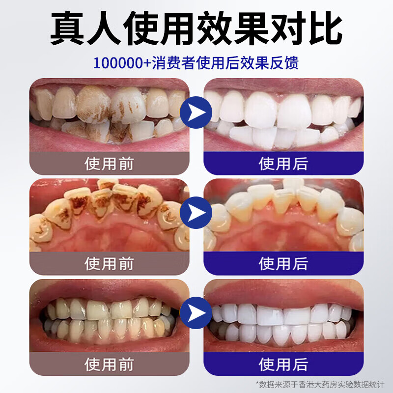 香港大药房美白牙膏去黄去渍美白除臭清新口气亮白抗牙菌斑烟渍结石清新护龈 1盒装【买2送1】美白去渍