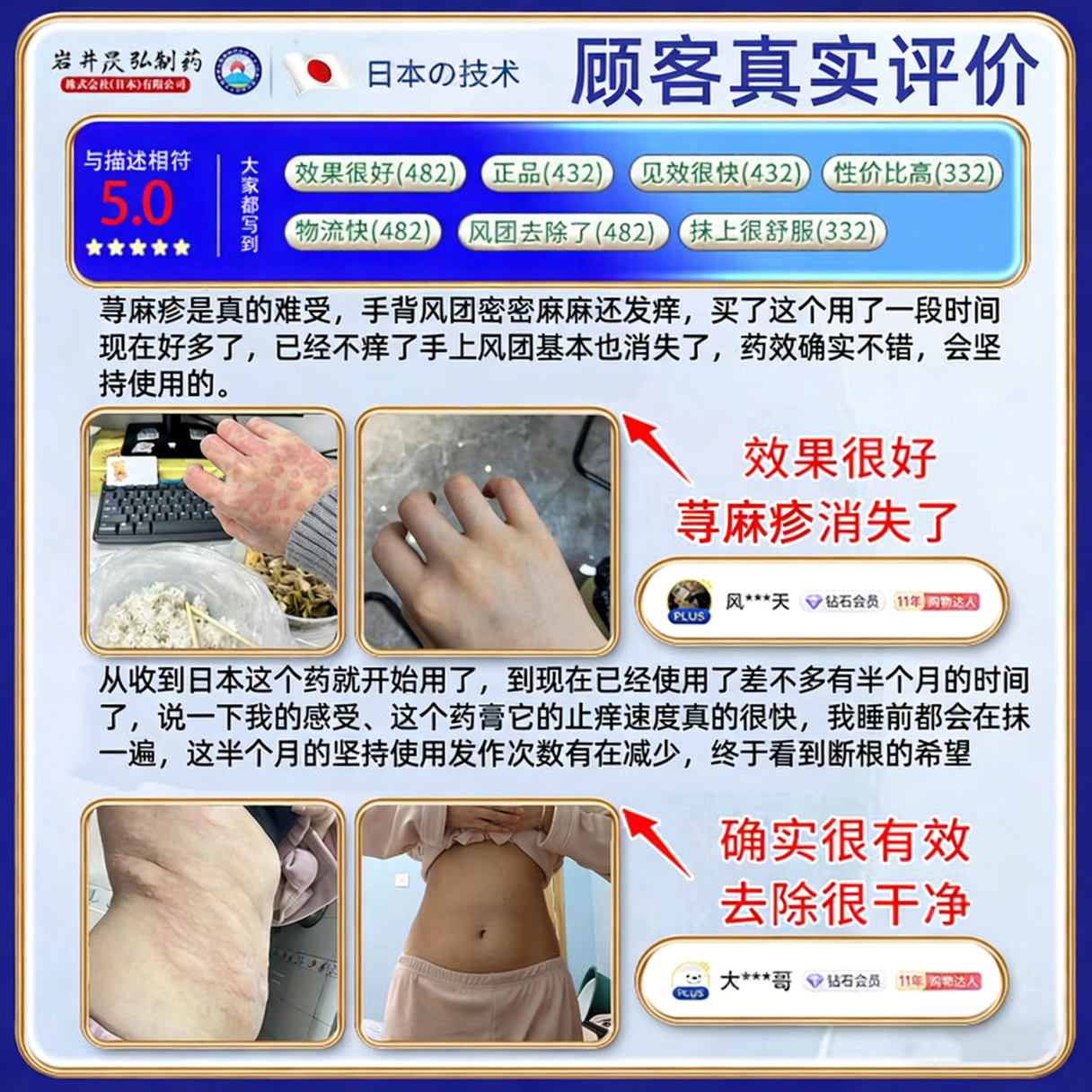 岩井昃弘荨麻疹药过敏止痒断i根增强免疫力荨麻疹专用膏药急慢性 【1盒】100%包消除 过敏止痒斷根皮肤瘙痒增强免疫膏药