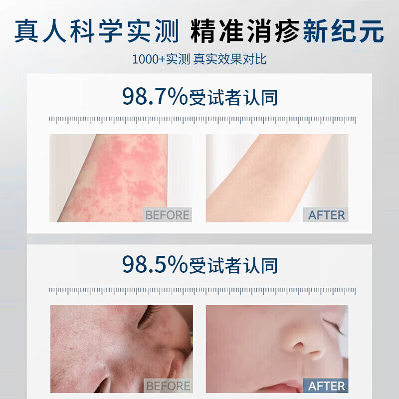 同仁堂【一抹止痒】抑菌止痒药膏皮肤瘙痒皮炎湿疹干燥真菌感染越抓越痒 1支【温和不刺激】一抹止痒 皮肤湿疹膏止痒抑菌皮肤瘙痒去顽固湿毒