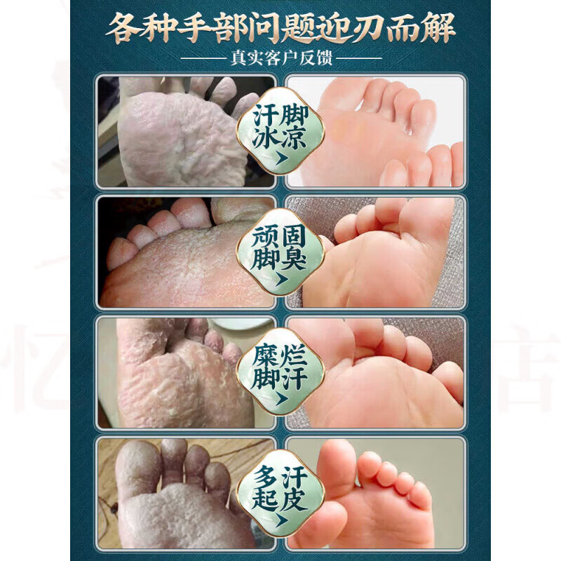 MRYU贝乐乐灵脚气喷雾【官方正品】臭脚出汗脚止汗脱皮杀菌脚痒止痒膏 五支装 买三贈二 官方自售