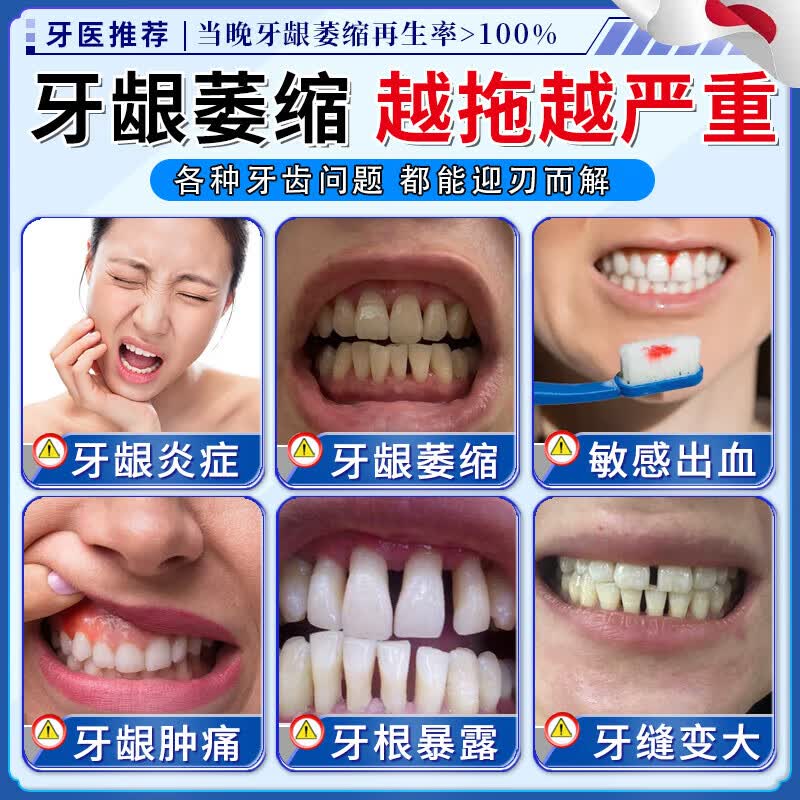 岩井昃弘牙膏护龈固齿牙龈萎缩修复再生专用喷剂牙根外露牙周炎固齿凝胶 单盒装喷剂 牙膏金榜第一重度牙齿松动进口