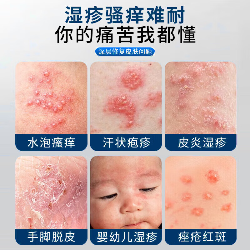 同仁堂【一抹止痒】抑菌止痒药膏皮肤瘙痒皮炎湿疹干燥真菌感染越抓越痒 1支【温和不刺激】一抹止痒 皮肤湿疹膏止痒抑菌皮肤瘙痒去顽固湿毒