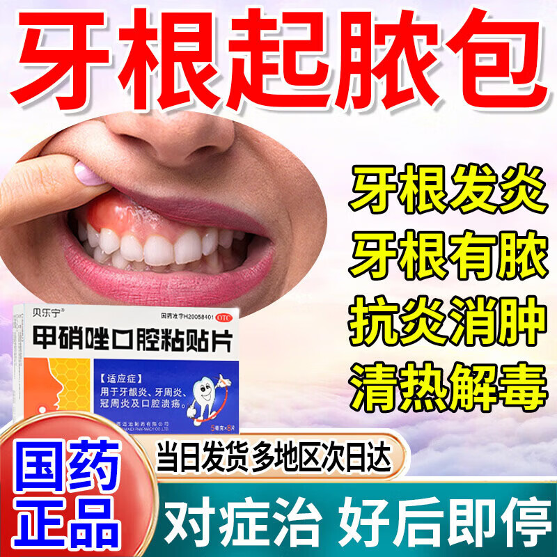 [贝乐宁]甲硝唑口腔粘贴片 5mg*8片 1盒装 牙龈肿痛消炎药鼓包特效化脓智齿牙痛消肿止痛药牙周炎牙龈炎专用药牙根长脓疱 牙龈红肿 口腔溃疡