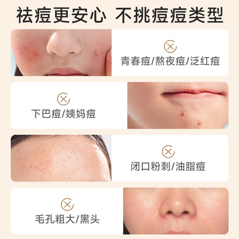 老中医(LAOZHONGYI)祛痘膏痘清霜男女士 淡化痘印痘坑痘疤青少年去青春痘黑头粉刺 痘清霜20g