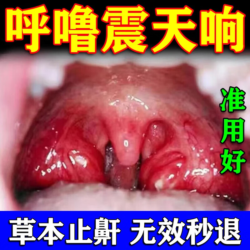 川井打呼噜止鼾神器打呼噜男士重度打鼾专用神器隔音日本进口医疗器械 买3送2【疗程装】-店家主推 京东折扣/优惠券