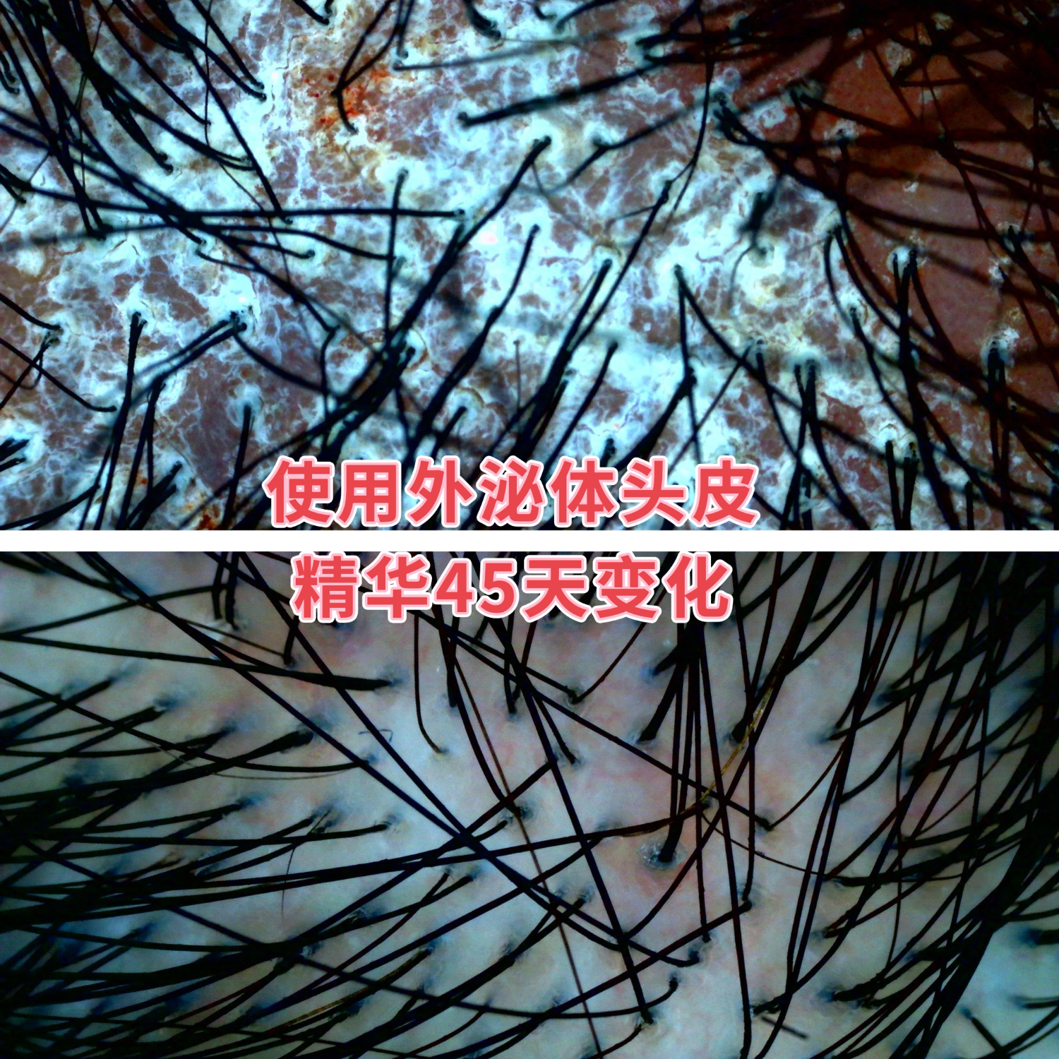 泌伶头皮紧致敏修精华液 头油 头屑 营养毛囊 头皮 K衰按摩上液器 白色