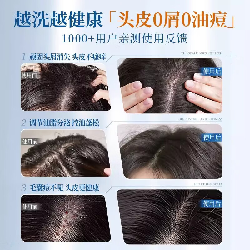 儒意二硫化硒去屑清洁洗发水毛囊止痒控油蓬松炎洗头膏露正品 【蓝玫瑰香】二硫化硒洗发水800g