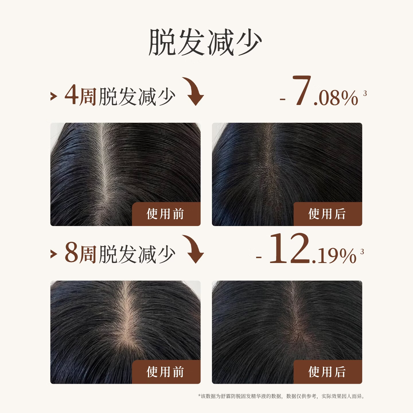 舒霖防脱固发洗发水脱发侧柏叶何首乌植萃洗发露护发养发头皮精华防断 【防脱套装】防脱洗发水330g+防脱精华