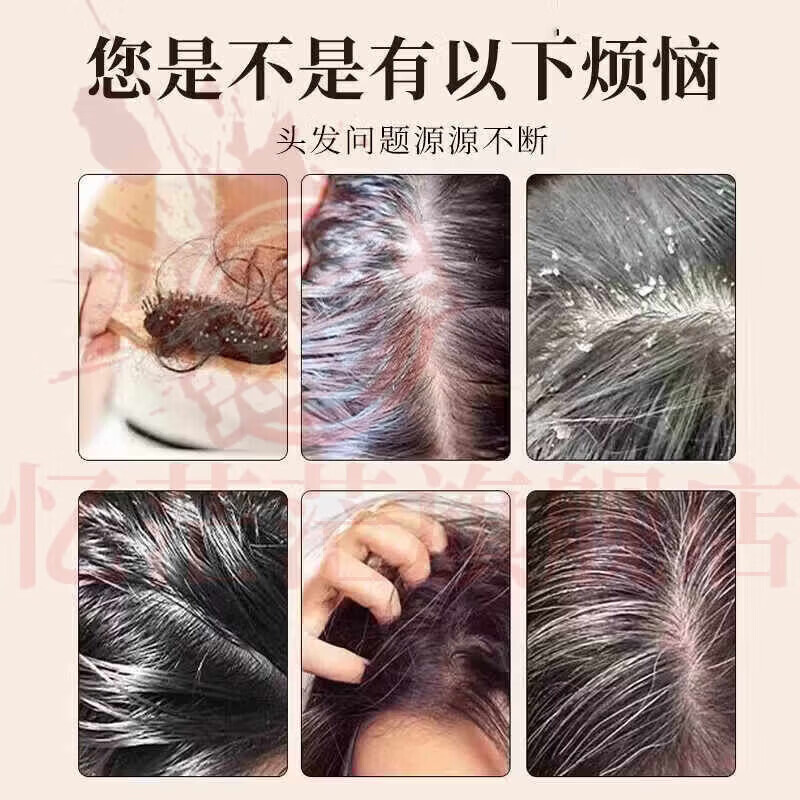 MRYU娇光增发密发洗发水防脱固发育发强韧发根减少断发掉发控油蓬松 【5瓶特惠装 重度脱发】 官方自售