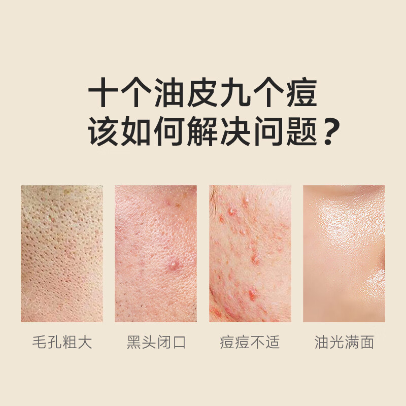 老中医(LAOZHONGYI)痘清洗面奶祛痘青少年无皂基男女士控油除螨虫去黑头缩毛孔洁面乳 【清洁祛痘】痘清洗面奶120g