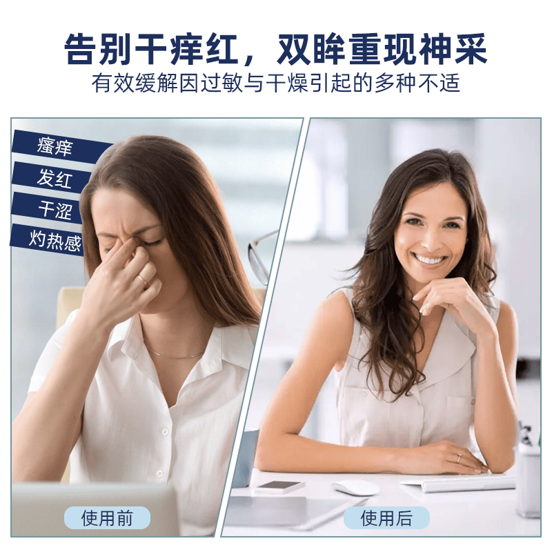 VISUfarma依克多因滴眼液-隐形眼镜/美瞳眼药水缓解过敏眼疲劳