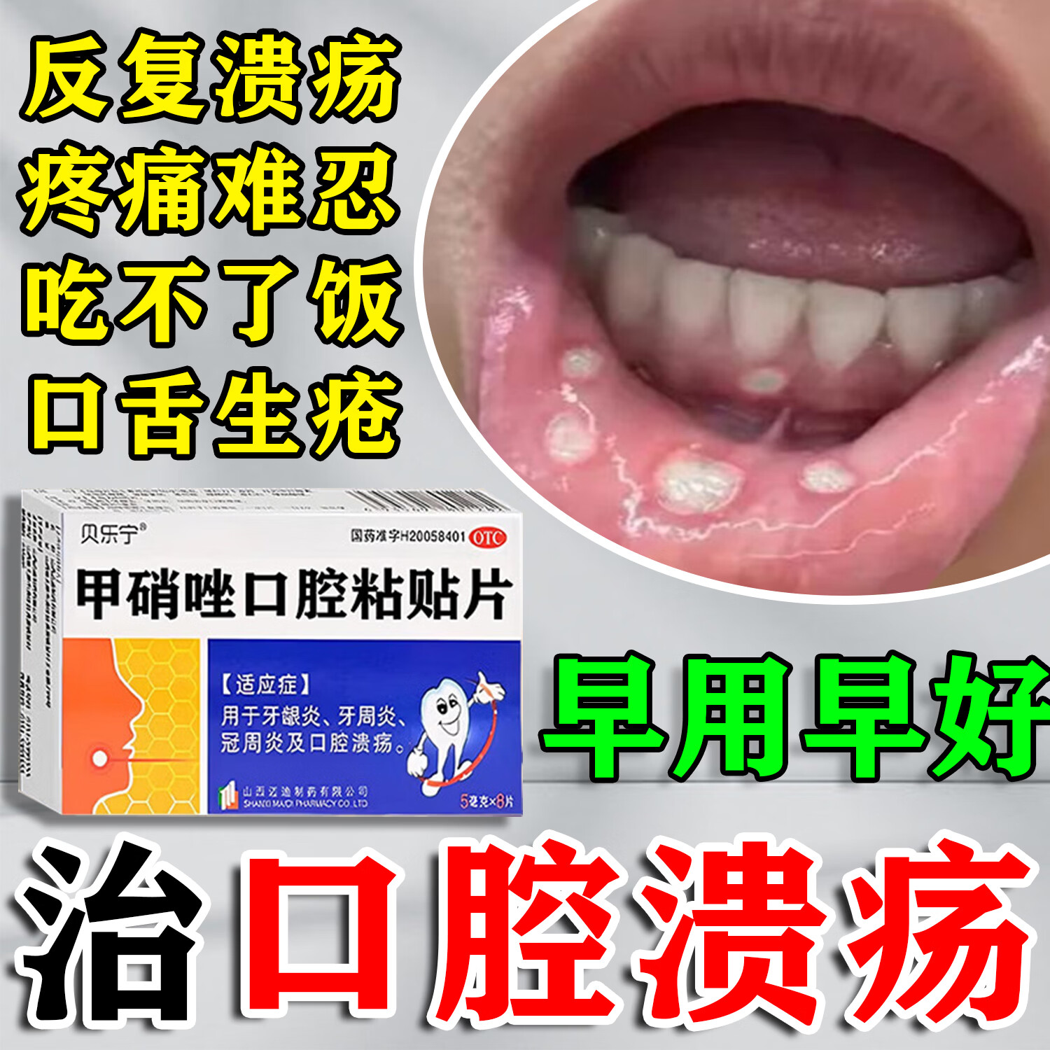 [贝乐宁]甲硝唑口腔粘贴片 5mg*8片 1盒装 口腔溃疡专用特新效的药口腔溃疡贴片含片舌头溃疡口舌生疮嘴唇起泡上火 国药正品 药房直发
