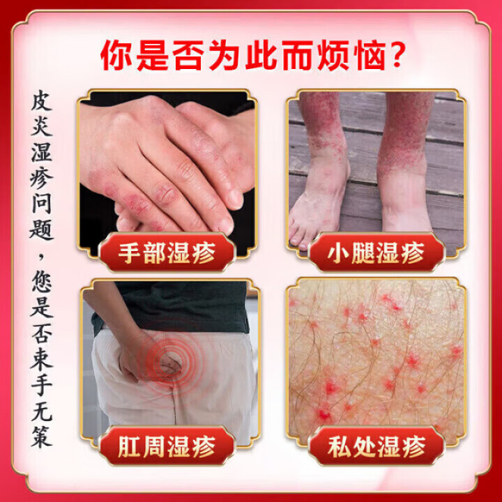 sosk康德西医用皮肤护理软膏湿疹皮炎湿疹痒皮肤瘙痒 1盒【体验装】