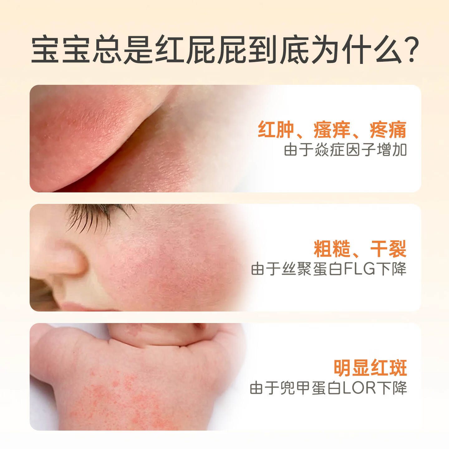 水萌宝精萃紫草油婴幼儿护臀油紫草膏新生儿屁屁霜脖子红按摩油保湿润肤 【舒缓护臀 宝妈必备】紫草油30g