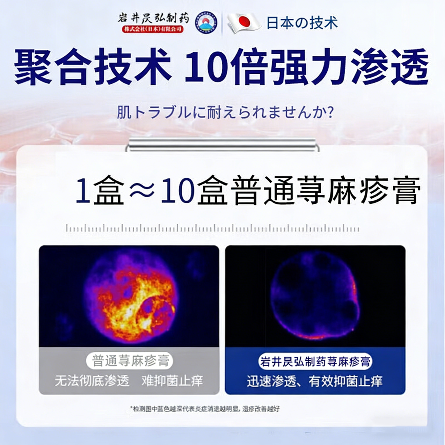 岩井昃弘荨麻疹药过敏止痒断i根增强免疫力荨麻疹专用膏药急慢性 【1盒】100%包消除 过敏止痒斷根皮肤瘙痒增强免疫膏药
