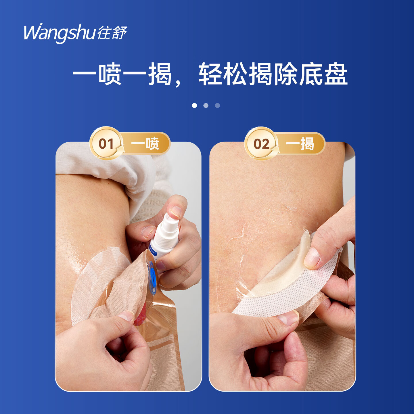 往舒黏胶剥离剂 造口底盘除胶剂不含酒精去除胶剂 黏胶剥离剂60ml*2