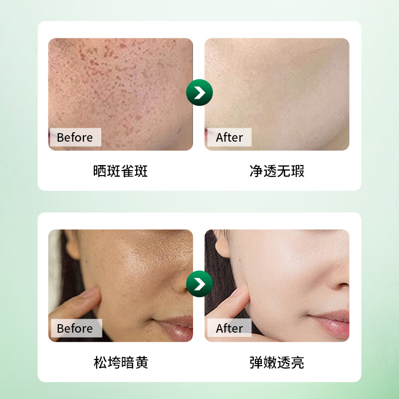 莘护药业德国法兰药业柿叶膏面霜润滑保湿霜秋冬季保湿补水滋润猪油膏 三瓶装