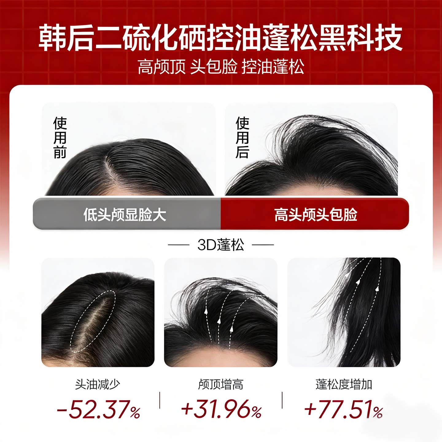 韩后（Hanhoo）洗发水男女士去屑控油二硫化硒洗发露洗头膏清爽净澈洗发液 韩后二硫化硒去屑控油洗发露500g*1瓶+3袋体验装