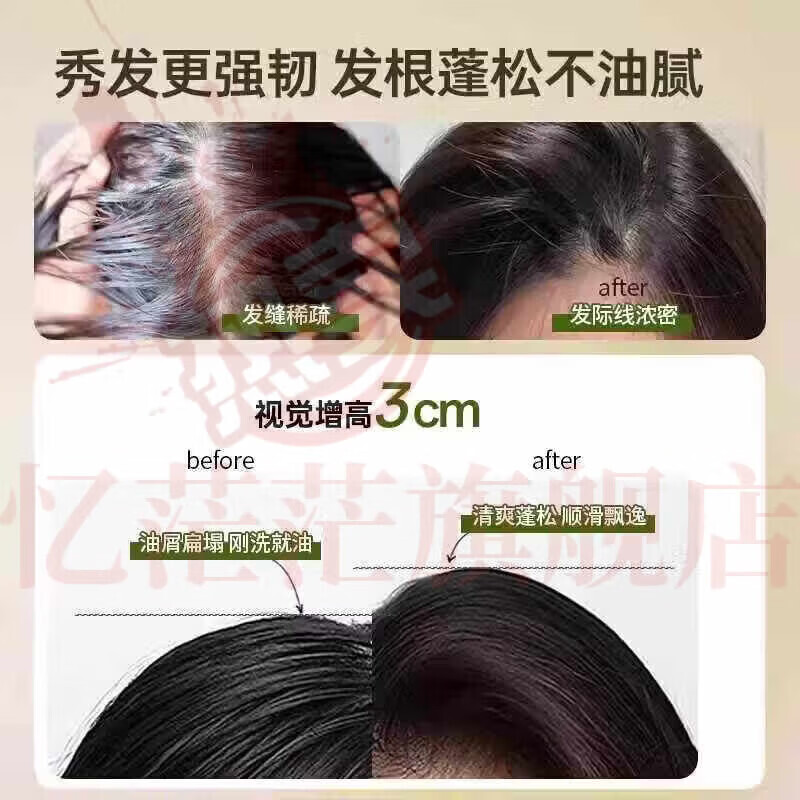 MRYU娇光增发密发洗发水防脱固发育发强韧发根减少断发掉发控油蓬松 【5瓶特惠装 重度脱发】 官方自售