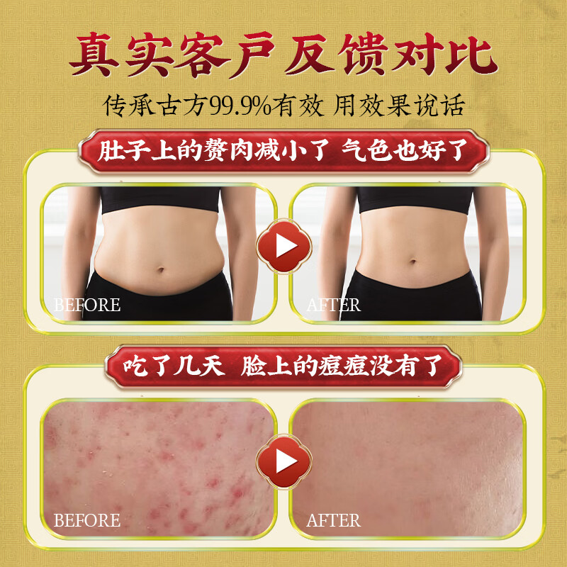 香港大药房有限公司祛湿丸无湿丸无湿轻排鸡内金去除湿气祛湿健脾养胃调湿气重伏湿膏 3盒装【肚大口臭舌苔白厚】买2送1 25g*3盒